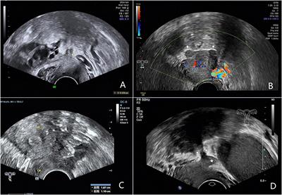 research projects in ultrasound